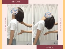 整体院 來花 福岡薬院店(KOHANA)/Bifo/Afuta 1（反り腰・猫背）