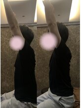 ゆくり/肩がスムーズに上がる