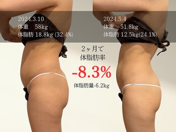 マルノウチ サロン(MARUNOUCHI salon)/30代のお客様/2ヶ月 担当:加藤