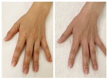 キレイテ 福岡天神店/くすみ・むくみでお悩みの方