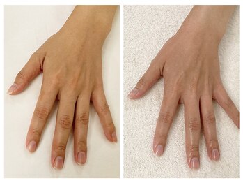 キレイテ 福岡天神店/くすみ・むくみでお悩みの方