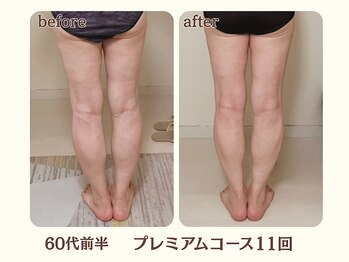 ヨサパーク ハーブ イムア(YOSA PARK imua)/◎お客様の変化