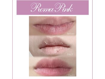 リップピンク 武蔵小杉店(lip pink)/　黒ずみ、くすみ解決！