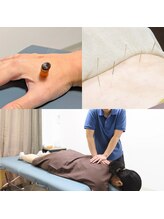 パウズ(Paws)/鍼灸×整体マッサージ施術