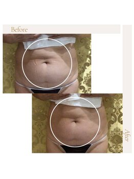 fallon beauty　痩身/フェイシャル/フェム・オムケア/アロマ/ボディケア/痩身キャビMAX