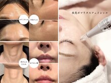 アンフェム(Anfem)の雰囲気（気になる箇所のシワ/毛穴/たるみに韓国の水光ボツリヌトキシン）