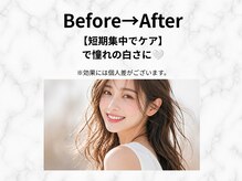 エミリアホワイトニング(EMIRIA WHITENING)/憧れの白さへ