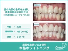 クレア(Crea)/【ホワイトニング症例写真】
