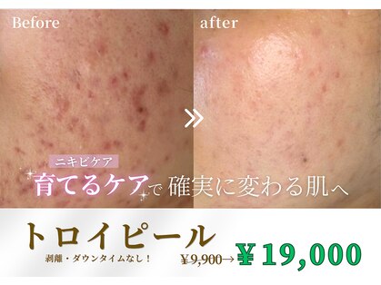 ウノ アッベリーナ(UNO × abbel'lina)の写真