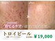 ウノ アッベリーナ(UNO × abbel'lina)の写真