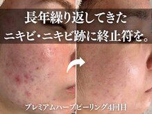 アール(ar.)の雰囲気（長年繰り返してきたニキビ・ニキビアトのお悩みに終止符を！）
