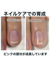 プレシャスハート 広島(Precious Heart)/◆ネイルケアでの育成◆