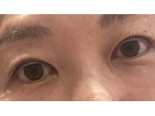 ビューティーアミューズメント 山鼻店(BEAUTY AMUSEMENT)/岩切7月14日