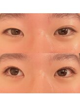 ラシュレ(BEAUTY CONCIERGE RASSURER)/まつ毛が上がると目ヂカラUP◎