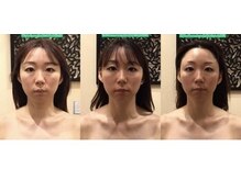 アジール 長岡リバーサイド千秋店(agir)/before/after画像