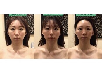 アジール 長岡リバーサイド千秋店(agir)/before/after画像