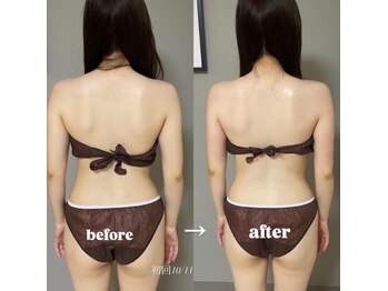 エヌボーテ(N. beaute)/Before→After 5回目