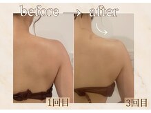 アンバー 恵比寿(AMBER)/巻き肩の方にもおすすめ！