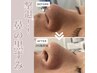【人気のHARI美容】VOSサロンケア3日間のホームケア付き¥22,000