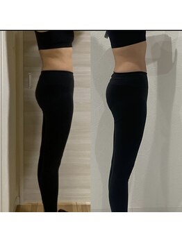 リノア(LINORE)/ヒップアップ