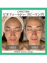 アマナ(AMANA)/サンブレイズ西山選手の美の秘訣