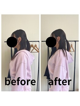 熊本カワル整体 JR上熊本駅院/ストレートネック