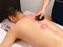 元気の森リラクゼーション/カッサ＋カッピング