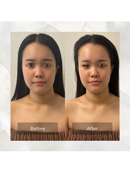 サワエギンザ(SAWAEGINZA)/before→after