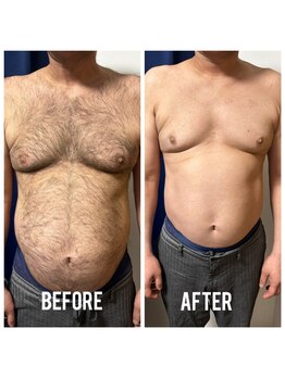 シェービーズ(shavys)/上半身(顔無）