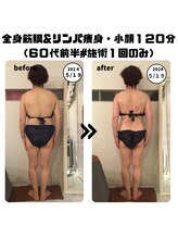 シェルシア(Cielcia)/全身筋膜＆リンパ痩身+小顔120分