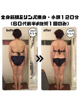 シェルシア(Cielcia)/全身筋膜＆リンパ痩身+小顔120分