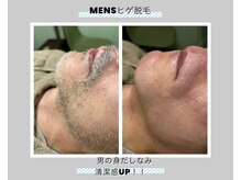 ルテラ(Lutella)の雰囲気（メンズ大歓迎♪お悩みご相談下さい！全身360度脱毛可能です◎）