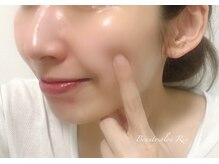 アトリエリン 小牧本店(Atelier Rin)/ぷるんと赤ちゃん肌に