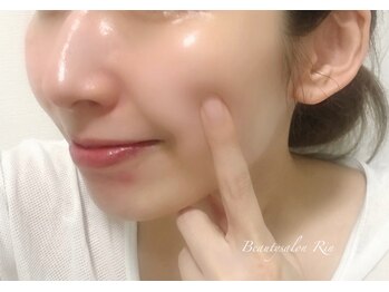 アトリエリン 小牧本店(Atelier Rin)/ぷるんと赤ちゃん肌に