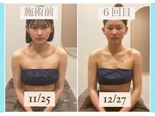 千歳の女神 三河安城店/【施術風景】Before/After