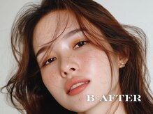 ビーアフターサロン 恵比寿本店(B<AFTER SALON)/海外モデル風の立体フェイスへ