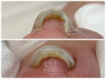 エフ(f)の雰囲気（ほとんどのお客様が施術後すぐに効果を実感されています）