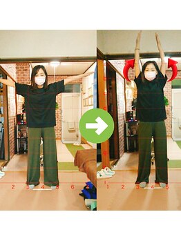 サプライズ整体院/30代ママさんの肩こり初回結果