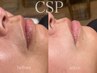 CSP【圧倒的美白とハリが叶うフェイシャルワックス】