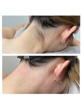 サンキュービューティーサロン 横浜関内(39 beauty salon.)/後れ毛Wax