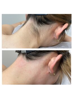 サンキュービューティーサロン 横浜関内(39 beauty salon.)/後れ毛Wax