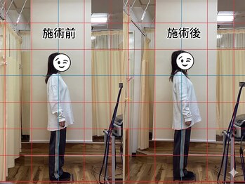 はばたき鍼灸整骨院/before/after