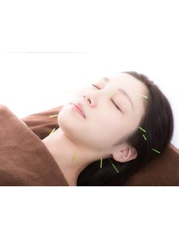 鍼灸施術を受けたい