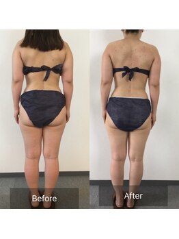 ボディメイクサロンアプローズ/メリハリボディ