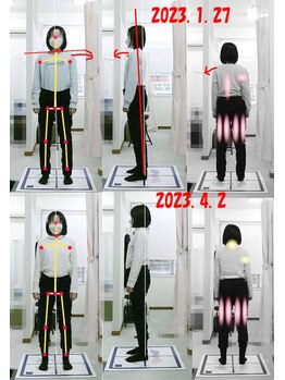 姫路なごみ整体院 なごみ鍼灸院/改善例（姿勢の悪や不眠など）