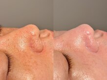 ルーナジェーナ(Luna llena)/池袋　エステ　ルーナジェーナ