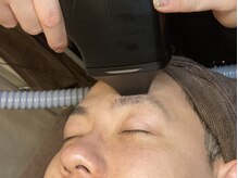 パルファム/眉毛フラッシュ脱毛