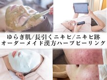 症例多数/毛穴×幹細胞×ハーブピーリング/ニキビケア