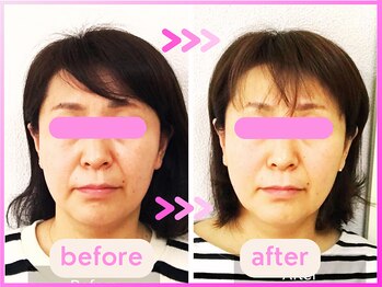 ホリハ整体院/*Before&After* 美顔デザイン