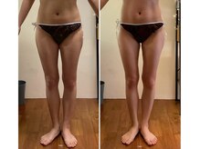 ニコワ(Nicowa)/Nicowaの痩身★BeforeAfter